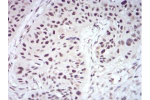 Immunohistochemistry (IHC) image for anti-Wilms Tumor 1 Associated Protein (WTAP) (AA 91-201) antibody (ABIN5542406)