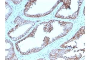 Immunohistochemistry (IHC) image for anti-CD47 (CD47) (AA 18-135) antibody (ABIN6941214)