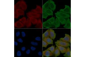 ABIN6266262 and ABIN6277409 staining Hela cells(30 min of UV treatment) by IF/ICC. (POMC Antikörper  (C-Term))