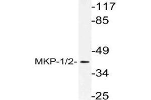Western blot (WB) analysis of MKP-1/2 antibody in extracts from Jurkat cells. (DUSP1 Antikörper)
