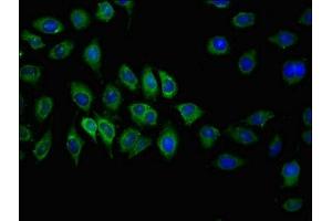 Immunofluorescent analysis of A549 cells using ABIN7146636 at dilution of 1:100 and Alexa Fluor 488-congugated AffiniPure Goat Anti-Rabbit IgG(H+L) (ABCC2 Antikörper  (AA 724-947))