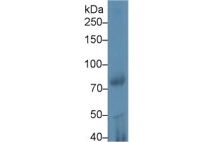 Western Blot; Sample: Rat Testis lysate; Primary Ab: 1µg/ml Rabbit Anti-Mouse iPLA2 Antibody Second Ab: 0. (PLA2G6 Antikörper  (AA 481-702))
