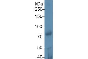 Western Blot; Sample: Rat Testis lysate; Primary Ab: 1µg/ml Rabbit Anti-Mouse iPLA2 Antibody Second Ab: 0. (PNPLA2 Antikörper  (AA 481-702))