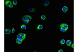 Immunofluorescent analysis of MCF-7 cells using ABIN7173155 at dilution of 1:100 and Alexa Fluor 488-congugated AffiniPure Goat Anti-Rabbit IgG(H+L) (TMEM222 Antikörper  (AA 77-164))