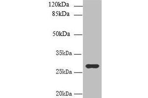 Western blot All lanes: UTP23 antibody at 7 μg/mL + Mouse liver tissue Secondary Goat polyclonal to rabbit IgG at 1/10000 dilution Predicted band size: 29, 17 kDa Observed band size: 29 kDa (UTP23 Antikörper  (AA 1-249))