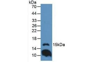 Western blot analysis of Mouse Lung Tissue. (IL1F9 Antikörper  (AA 5-149))