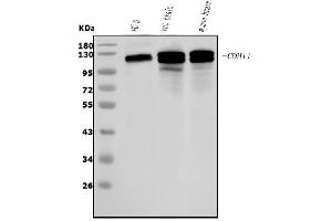 Western blot analysis of OB Cadherin/CDH11 using anti-OB Cadherin/CDH11 antibody (ABIN5518978).
