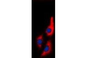 Immunofluorescent analysis of MYL9 staining in Jurkat cells. (MYL9 Antikörper  (N-Term))