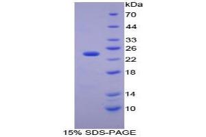 SDS-PAGE analysis of Mouse Carbonic Anhydrase I Protein. (CA1 Protein)