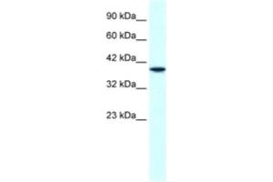 Western Blotting (WB) image for anti-H6 Family Homeobox 1 (HMX1) antibody (ABIN2460518) (HMX1 Antikörper)