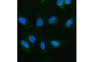 IF analysis of cIAP1/BIRC2 using anti-cIAP1/BIRC2 antibody (ABIN5693185). (BIRC2 Antikörper  (AA 320-570))
