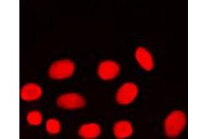 Immunofluorescent analysis of ADA2A staining in MCF7 cells. (TADA2L Antikörper  (Center))