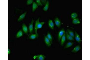 Immunofluorescent analysis of A549 cells using ABIN7174731 at dilution of 1:100 and Alexa Fluor 488-congugated AffiniPure Goat Anti-Rabbit IgG(H+L) (PARP11 Antikörper  (AA 1-245))