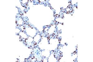 Immunohistochemistry of paraffin-embedded rat lung using  Rabbit mAb (ABIN7265434) at dilution of 1:100 (40x lens). (ADAM15 Antikörper)