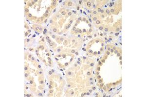 Immunohistochemistry of paraffin-embedded human kidney using SPIN2B antibody (ABIN5975141) at dilution of 1/100 (40x lens). (Spindlin 2B Antikörper)