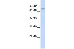 Western Blotting (WB) image for anti-ADAM Metallopeptidase Domain 15 (ADAM15) antibody (ABIN2459014) (ADAM15 Antikörper)