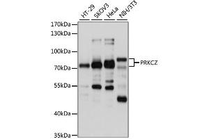 Western blot analysis of extracts of various cell lines, using PRKCZ antibody (ABIN2564714) at 1:1000 dilution. (PKC zeta Antikörper)