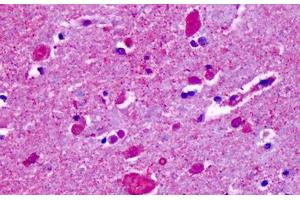 Anti-CELSR2 antibody IHC staining of human brain, cortex, cerebellum. (CELSR2 Antikörper  (N-Term))