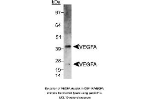 Image no. 1 for anti-Vascular Endothelial Growth Factor A (VEGFA) (AA 150-250), (Internal Region) antibody (ABIN363519) (VEGFA Antikörper  (Internal Region))