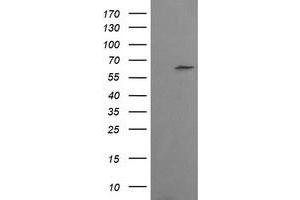 Image no. 1 for anti-Chaperonin Containing TCP1, Subunit 8 (Theta)-Like 2 (CCT8L2) antibody (ABIN1497481) (CCT8L2 Antikörper)