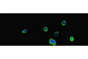 Immunofluorescent analysis of HepG2 cells using ABIN7170309 at dilution of 1:100 and Alexa Fluor 488-congugated AffiniPure Goat Anti-Rabbit IgG(H+L) (SSTR2 Antikörper  (AA 304-369))