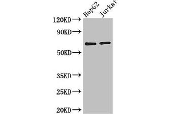RUNX1T1 Antikörper  (AA 416-525)