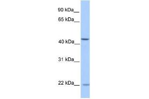 ZNF485 antibody used at 0. (ZNF485 Antikörper  (N-Term))