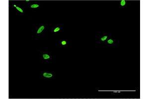 Immunofluorescence of monoclonal antibody to EWSR1 on HeLa cell. (EWSR1 Antikörper  (AA 358-453))