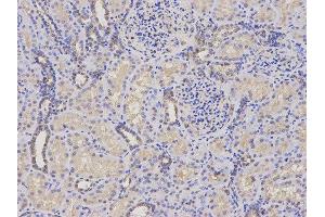 Immunohistochemistry (IHC) image for anti-Proteasome (Prosome, Macropain) 26S Subunit, ATPase, 4 (PSMC4) antibody (ABIN1874384) (PSMC4 Antikörper)