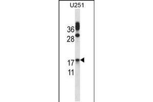 Western blot analysis in U251 cell line lysates (35ug/lane). (CGB Antikörper  (AA 63-90))