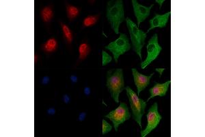 ABIN6264663 and ABIN6278106 staining  cells by IF/ICC.