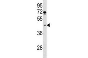 ISL1 antibody western blot analysis in MDA-MB231 lysate. (ISL1 Antikörper  (AA 156-185))
