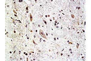 Formalin-fixed and paraffin embedded: rat spinal cord tissue labeled with Anti-Neurofascin Polyclonal Antibody, Unconjugated (ABIN727325) at 1:200, followed by conjugation to the secondary antibody and DAB staining (NFASC Antikörper  (AA 501-650))