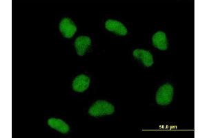 Immunofluorescence of purified MaxPab antibody to TDG on HeLa cell. (TDG Antikörper  (AA 1-410))