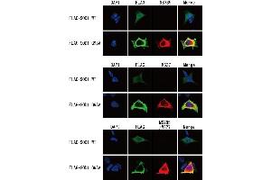 Detection of SOD1 mutants by immunocytochemistry Flag-tagged SOD1 wild type or G93A mutant-expressing HEK293 cells were fixed with 4 % paraformaldehyde/PBS for 10 min at R.