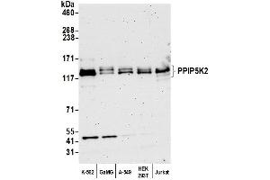 Western Blotting (WB) image for anti-diphosphoinositol Pentakisphosphate Kinase 2 (PPIP5K2) (AA 925-975) antibody (ABIN7450593) (HISPPD1 Antikörper  (AA 925-975))