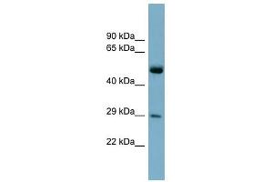 RAB27A antibody used at 1 ug/ml to detect target protein. (RAB27A Antikörper  (Middle Region))