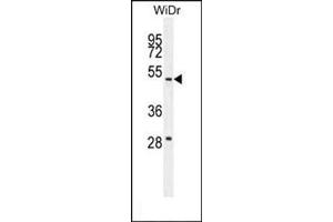 Western blot analysis in WiDr cell line lysates (35 µg/lane) using RT4I1 Antibody (C-term) Cat.