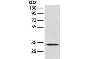 Western blot analysis of Jurkat cell using CD1D Polyclonal Antibody at dilution of 1:300 (CD1d Antikörper)