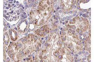 ABIN6268802 at 1/100 staining human kidney tissue sections by IHC-P. (EPH Receptor A3 Antikörper  (C-Term))