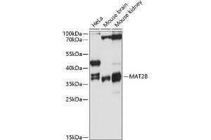 Western blot analysis of extracts of various cell lines, using MB antibody (ABIN6128286, ABIN6143576, ABIN6143577 and ABIN6215296) at 1:3000 dilution. (MAT2B Antikörper  (AA 1-334))