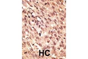 Immunohistochemistry (Paraffin-embedded Sections) (IHC (p)) image for anti-Low Density Lipoprotein Receptor-Related Protein 5 (LRP5) (AA 1538-1567), (C-Term) antibody (ABIN390099)