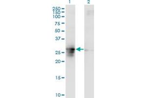 Western Blot analysis of FAM3B expression in transfected 293T cell line by FAM3B monoclonal antibody (M07), clone 1E7.