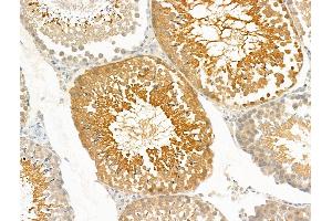 ABIN7094854 and ABIN7098905 at 1/100 staining Rat testis tissue by IHC-P. (PRRG4 Antikörper  (Internal Region))
