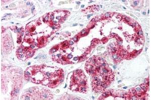 Human Kidney (formalin-fixed, paraffin-embedded) stained with HTRA2 antibody ABIN213932 at 5 ug/ml followed by biotinylated goat anti-rabbit IgG secondary antibody ABIN481713, alkaline phosphatase-streptavidin and chromogen.