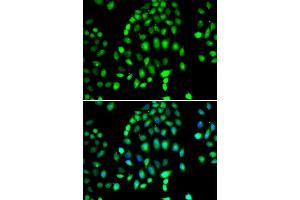 Immunofluorescence analysis of MCF7 cell using PARP3 antibody. (PARP3 Antikörper)