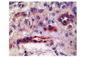 Immunohistochemistry (IHC) image for anti-VEGF Receptor 2 (VEGFR2) (N-Term) antibody (ABIN926995)