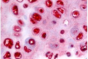 Anti-ADAMTS5 antibody  ABIN1048295 IHC staining of human cartilage. (ADAMTS5 Antikörper  (Metalloprotease Domain))