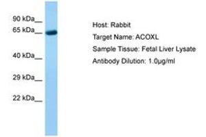 Image no. 1 for anti-Acyl-CoA Oxidase-Like (ACOXL) (AA 361-410) antibody (ABIN6750231) (ACOXL Antikörper  (AA 361-410))