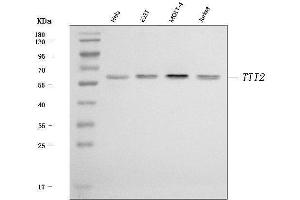 Western blot analysis of TTI2 using anti-TTI2 antibody (ABIN7602516).